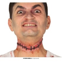 INGROSSO CICATRICE CUCITURA 25 C